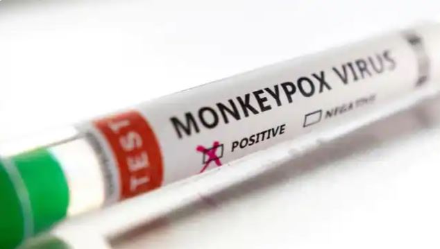 Monkeypox: Case: नोएडा-गाजियाबाद में मंकीपॉक्स के संदिग्ध मरीज मिलने के बाद हड़कंप, अलर्ट हुआ स्वास्थ्य विभाग