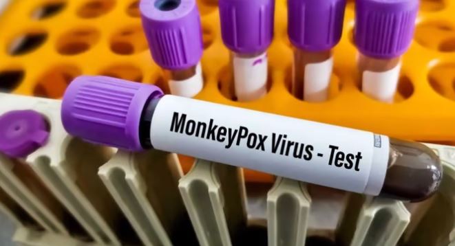 Monkeypox Case Delhi: दिल्ली में मिला पांचवा मंकीपॉक्स का मरीज, एलएनजेपी अस्पताल में कराया गया भर्ती