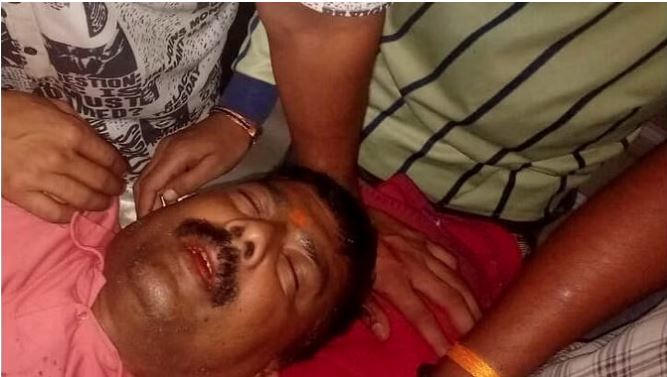 Kanpur News : स्कूटी सवार बदमाशों ने निर्दलीय प्रत्याशी के पति को मारी गोली, पुलिस बोली- मामला संदिग्ध