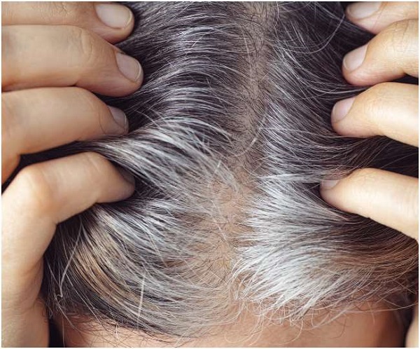 White Hair Home Remedies: सफेद बालों के लिए रामबाण हैं ये चीजें, लगाने से होंगे काले और घने बाल