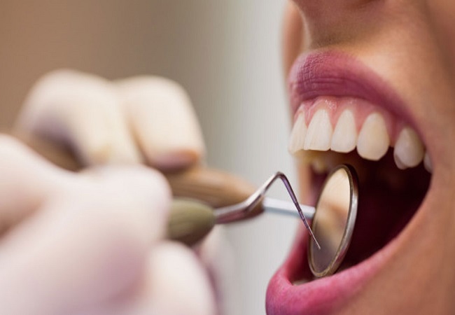 Dental Care: अगर आप दांतों की कैविटी से परेशान हैं तो अपनाएं ये घरेलू उपाय, गायब हो जाएगा दांतो का कीड़ा