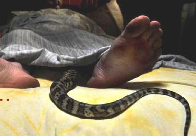 Snake Bite : सोते समय पैंट में घुसा सांप, किशोर के प्राइवेट पार्ट में डसा