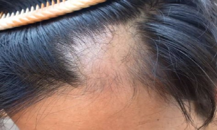 Hair Care Tips: इन चीजों का सेवन करने से बाल होते है खूबसूरत काले घने और हेल्दी बाल