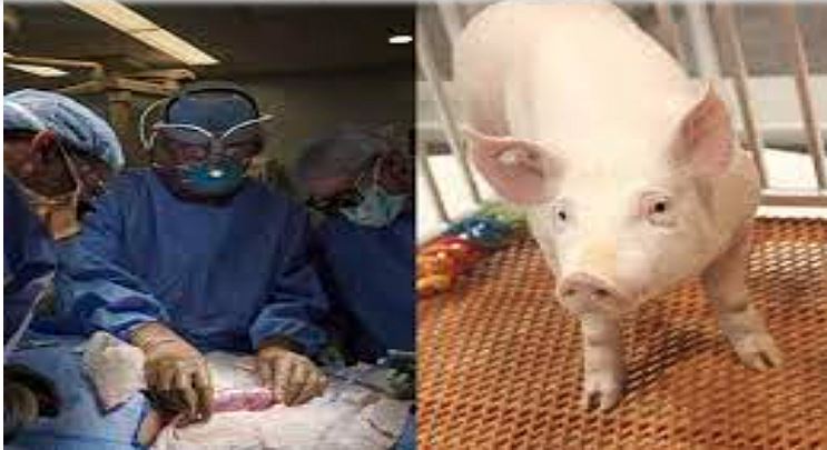 New Hope : इंसान के शरीर में सुअर की किडनी लगाने का डॉक्टरों ने किया नया सफल परीक्षण