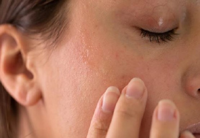 Dry skin should take special care