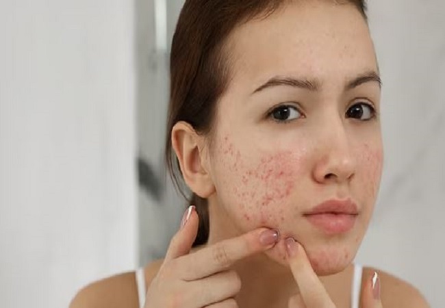 These things are harmful for the skin: खूबसूरती की दुश्मन है ये खाने वाली चीजें, तुरंत खाना छोड़ दें