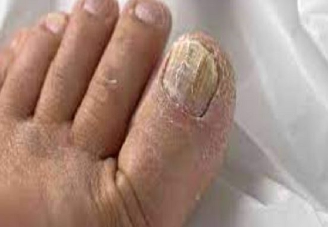 Ways to clean dirt accumulated in hands and feet