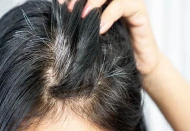 Solution to blacken white hair: सिर्फ चाय की पत्ती से ऐसे सफेद बालों को करें काला