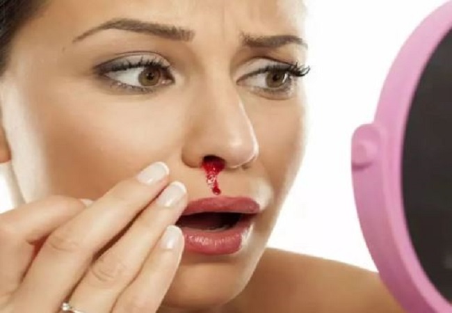 Nose bleeding in summer: गर्मियों में नाक से आने लगता है खून, तो इन घरेलू उपचार से मिलेगी आराम