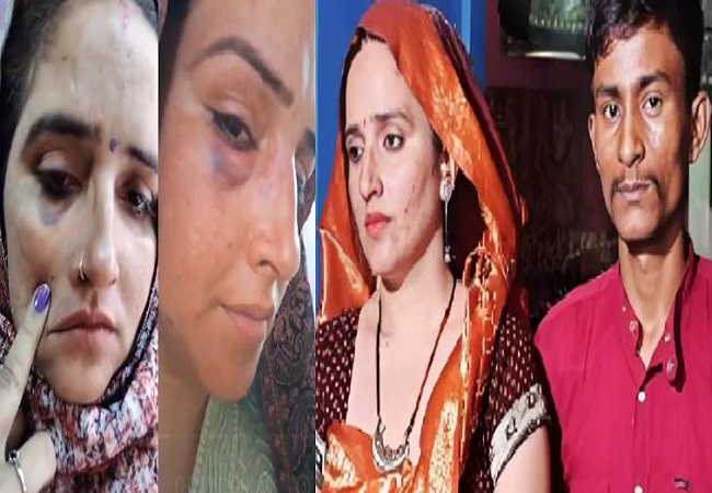 Seema Haider: सीमा हैदर और सचिन में मारपीट, चेहरे, मुंह और हाथ पर आई चोटें, वायरल वीडियो पर वकील ने बताई ये सच्चाई