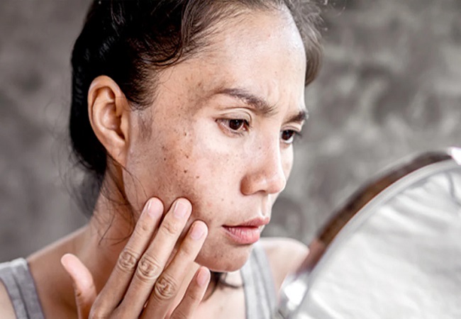 Ways to remove blemishes and spots: इन चीजों को चेहरे पर लगाने से दाग धब्बों से मिलेगा छुटकारा, निखरेगी रंगत
