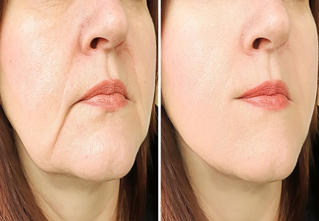 Ways to tighten wrinkles and skin: चेहरे की झुर्रियों को दूर करके स्किन को टाइट करती हैं ये चीजें