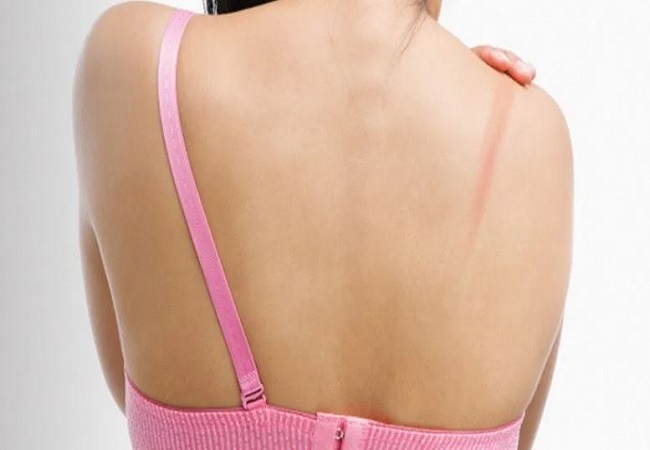 Side effects of wearing tight bra: टाइट ब्रा पहनने से ब्लड सर्कुलेशन बिगड़ने के अलावा होते हैं शरीर को कई नुकसान