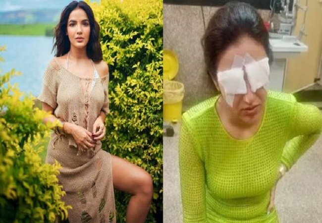 cornea of ​​actress Jasmine Bhasin's eyes got damaged