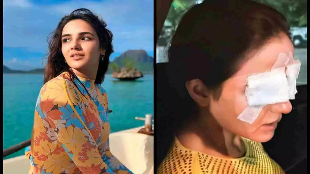 Jasmin Bhasin को आंखों से दिखाई देना हुआ बंद, कॉन्टैक्ट लेंस लगाते समय कॉर्निया में लगी चोट