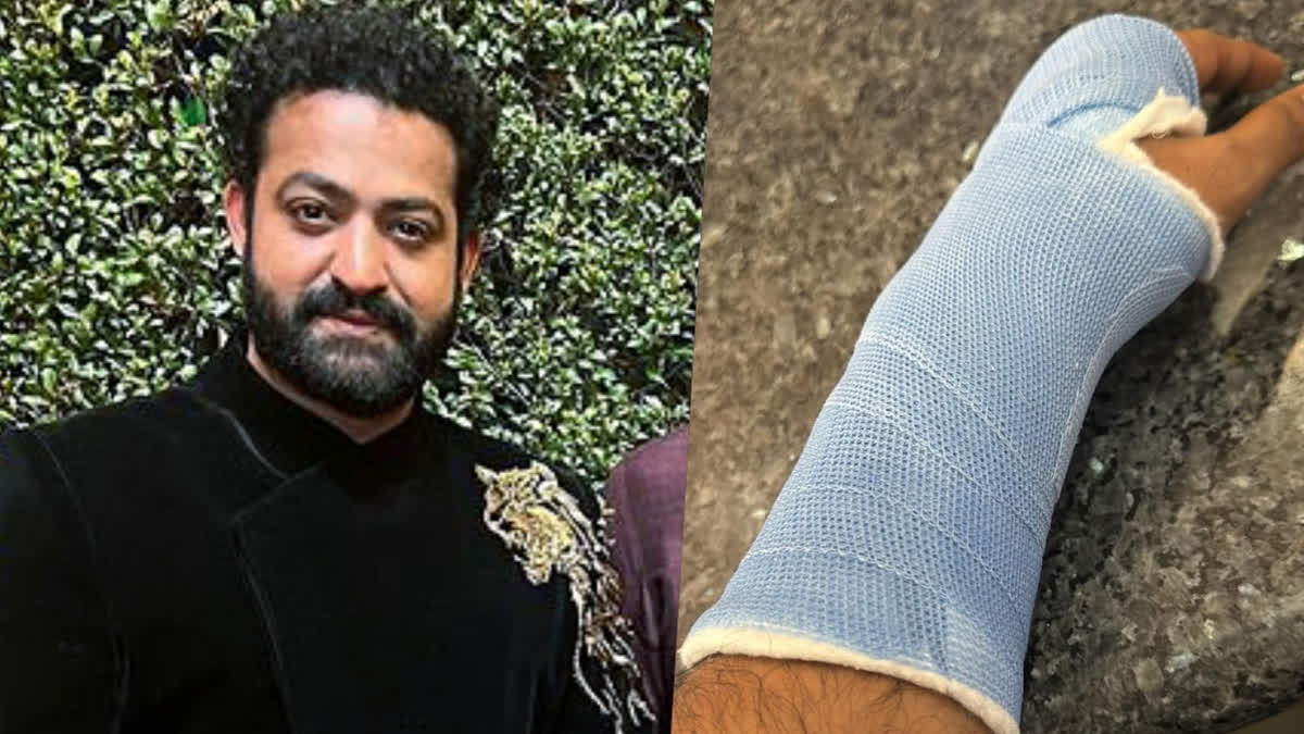 Jr NTR की कलाई पर लगी चोट, प्लास्टर देख चिंतित हुए फैन्स