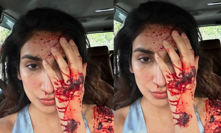 blood on actress Parul Gulati's face and hands.