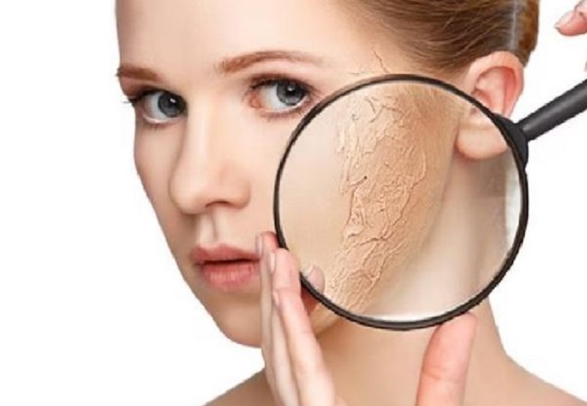 Skin care: किचन में मौजूद इन चीजों को लगाने से मिलेगा चेहरे की डेड स्किन से छुटकारा