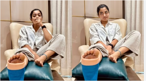 Rashmika Mandana health update: जिम में घायल हुई श्रीवल्ली, रश्मिका ने पोस्ट शेयर कर दी हेल्थ अपडेट