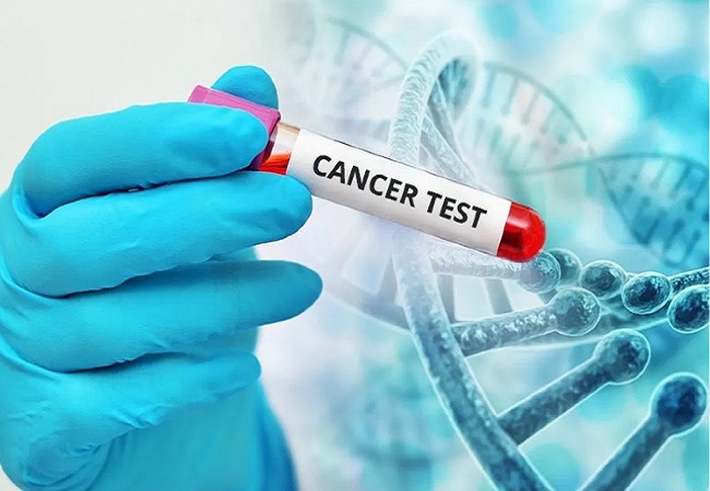 आस पास भी नहीं भटकेंगी कैंसर जैसी खतरनाक बीमारियां, बस कर लें ये छोटा सा काम