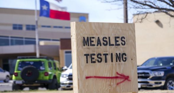 America ‘Measles’: अमेरिका में ‘खसरे’ ने बढ़ाई चिंता , लगातार बढ़ रही मरीजों की संख्या