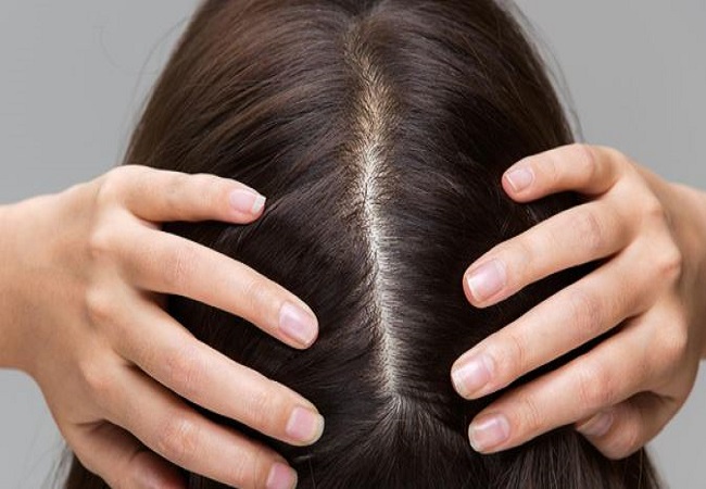 Benefits of applying glycerin to hair: शैंपू करने के बाद कंडीशनर की जगह ऐसे लगाएं ग्लिसरीन, सिल्की और स्मूद बाल देख हैरान रह जाएंगी आप