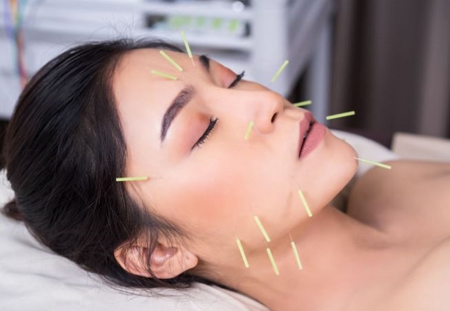 Benefits of facial acupuncture: खूबसूरत स्किन के लिए एक्ट्रेस मल्लिका से लेकर जरीन तक कराती है फेशियल एक्यूपंचर, पढ़ें इसके गजब के फायदे