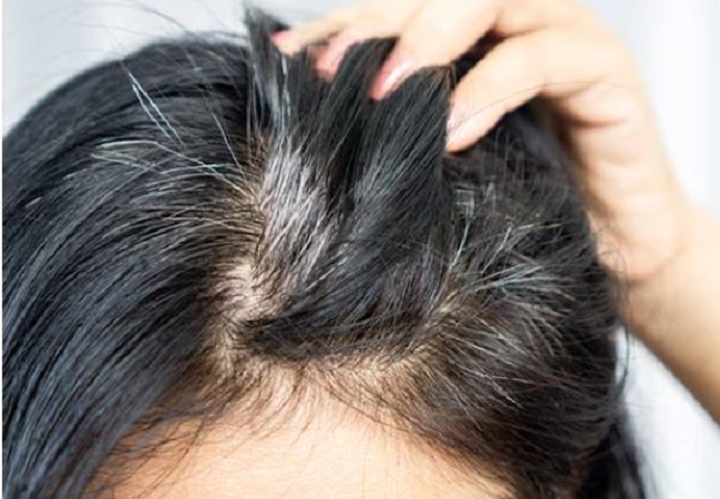 Hair dye from pomegranate peel: अनार के छिलकों को फेंकने की बजाय ऐसे बनाएं सौ प्रतिशत नेचुरल हेयर हाई