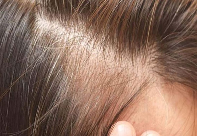 Hair care: पतले बालों से हैं परेशान तो, इस तेल को से मालिश से होंगे घने, चमकदार और हेल्दी बाल