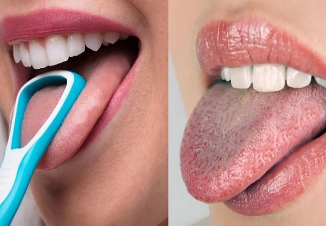 Tongue cleaning: दांतों को कई बार करते हैं ब्रश और जीभ की सफाई करना जाते हैं भूल, तो जान लें सेहत पर पड़ता है क्या असर