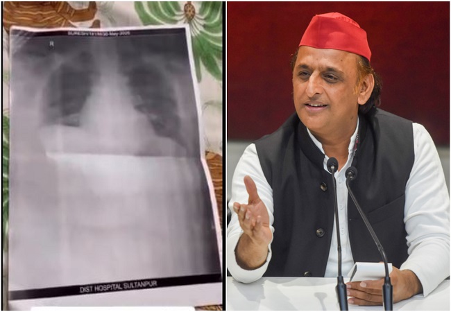 अखिलेश यादव, बोले- ये है भाजपा के कुशासन का एक्स-रे, विकास और निवेश की तरह इनकी जांच और इलाज भी कागजी है