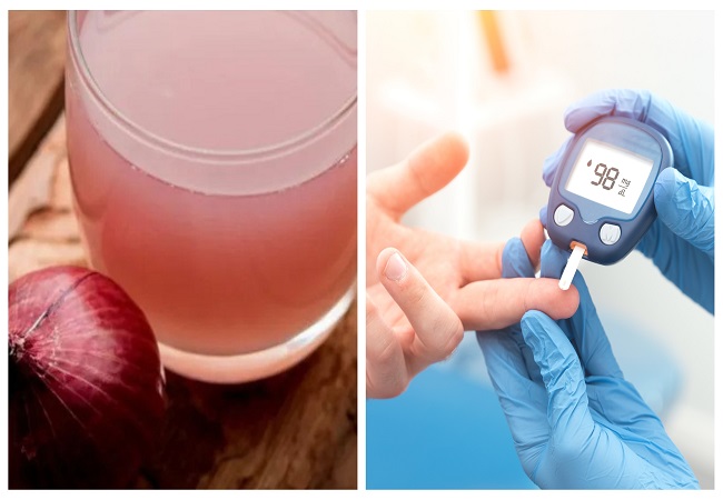 Research Report : प्याज का अर्क डायबिटीज के साथ कोलेस्ट्रॉल करता है कंट्रोल, शुगर का सबसे सस्ता इलाज