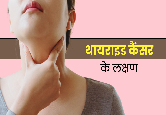 गले में दर्द को बिल्कुल ना करें इग्नोर ,कभी भी हो सकता है थायरॉइड कैंसर  का संकेत