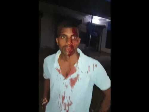 Maharajganj:खाद की दुकान के सेल्समैन से मारपीट, नौ आरोपितों पर केस दर्ज