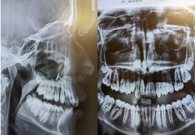 बेटी के दांत का X-ray कराने ले गई मां, रिपोर्ट देखकर चौंके डॉक्टर, खुल गया राज
