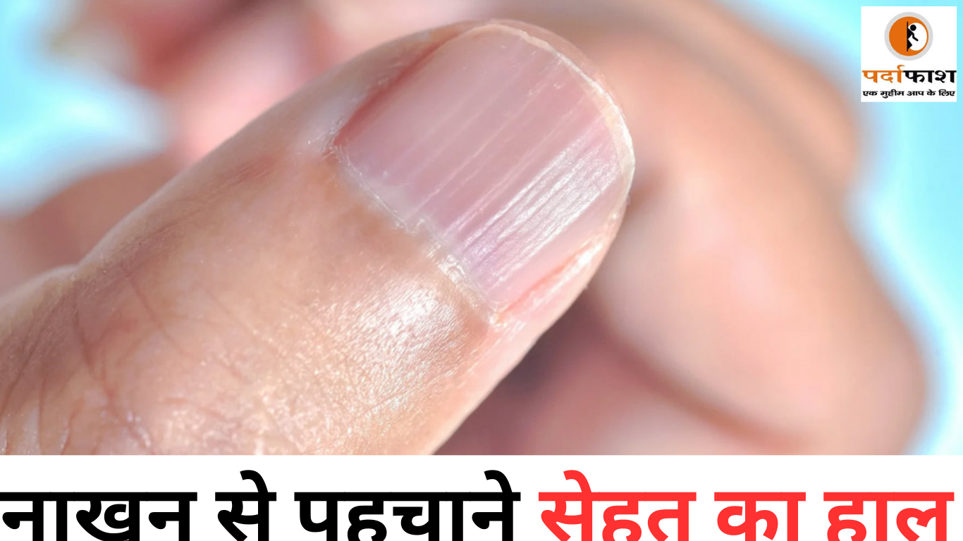 Health Tips :सेहत का हाल बता रहा आपका नाखून, ये लक्षण दिखते ही डॉक्टर से लें सलाह