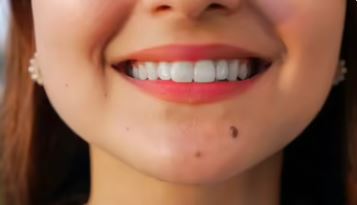 Samudrik Shastra : गालों पर तिल खूबसूरती में लगा देते हैं चार-चांद , जानें शुभ होता है या अशुभ ?