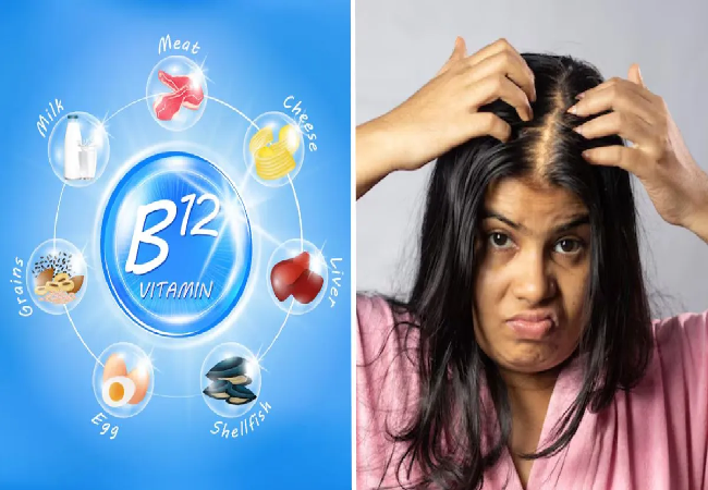 Health Tips : बालों की ग्रोथ रोक रही है Vitamin-B12 की कमी? ये Natural Resource करें शामिल