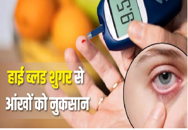 Health Tips : Vision Loss का कारण बन सकता है हाई बीपी या ब्लड शुगर, डॉक्टर ने बताया आंखों से दोनों का कनेक्शन