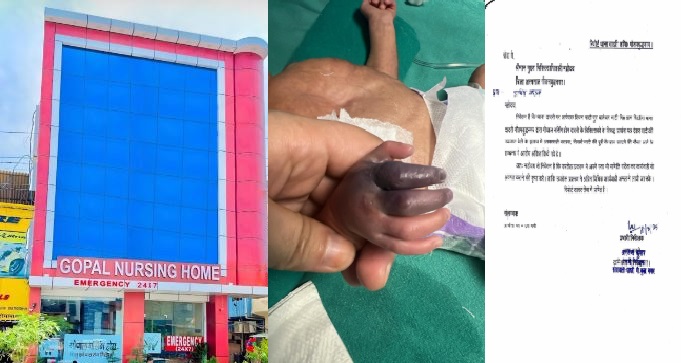 नोएडा में गोपाल नर्सिंग होम ने नवजात बच्ची का लापरवाही से किया गलत इलाज, दाहिने हाथ की उंगुलियां हुई खराब तो कहा-काटने पड़ेंगे हाथ, जिम्मेदार कौन?