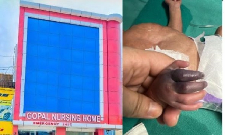 विवादों में रहे गोपाल नर्सिंग होम में नहीं है कोई बाल रोग विशेषज्ञ और नर्सिंग स्टाफ, नवजात का किया था गलत इलाज, काटनी पड़ी थी उंगलियां