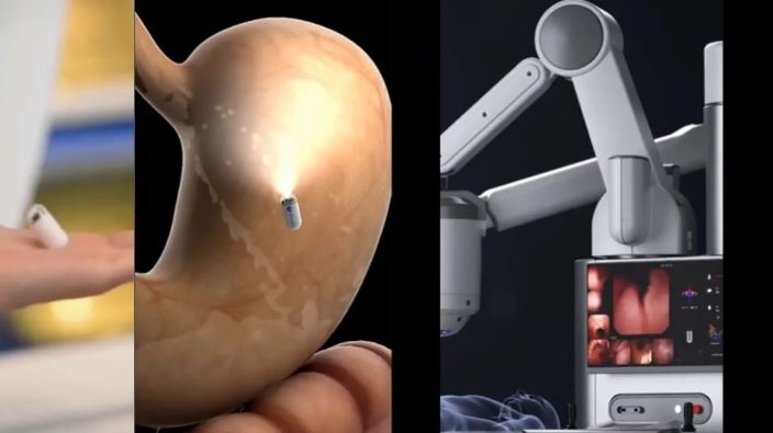 AI-powered capsule : AI-पावर्ड कैप्सूल खाने से हो जाएगी पेट की पूरी जांच ; चीन के वैज्ञानिकों ने कर दिया बड़ा कमाल