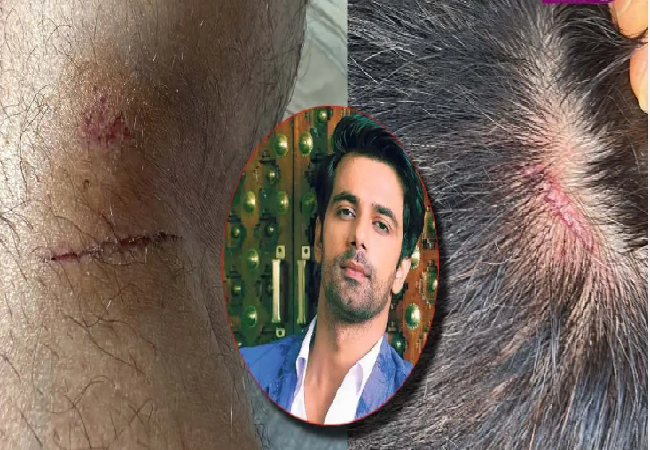 ‘मुंबई अब सेफ नहीं…’, पार्किंग को लेकर फेमस एक्टर के साथ हुई मारपीट