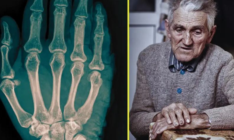 Weak Bones In Old Age : बुजुर्गों की कमजोर हड्डियां गंभीर फ्रैक्चर के पीछे की वजह, छोटी-छोटी बातों का ख्याल रखकर आप बड़ी समस्या से बच सकते हैं