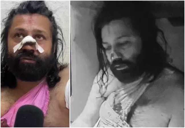 आशुतोष ब्रह्मचारी पर जानलेवा हमला, चलती ट्रेन में नाक काटने की कोशिश, टॉयलेट में छिपकर बचाई जान