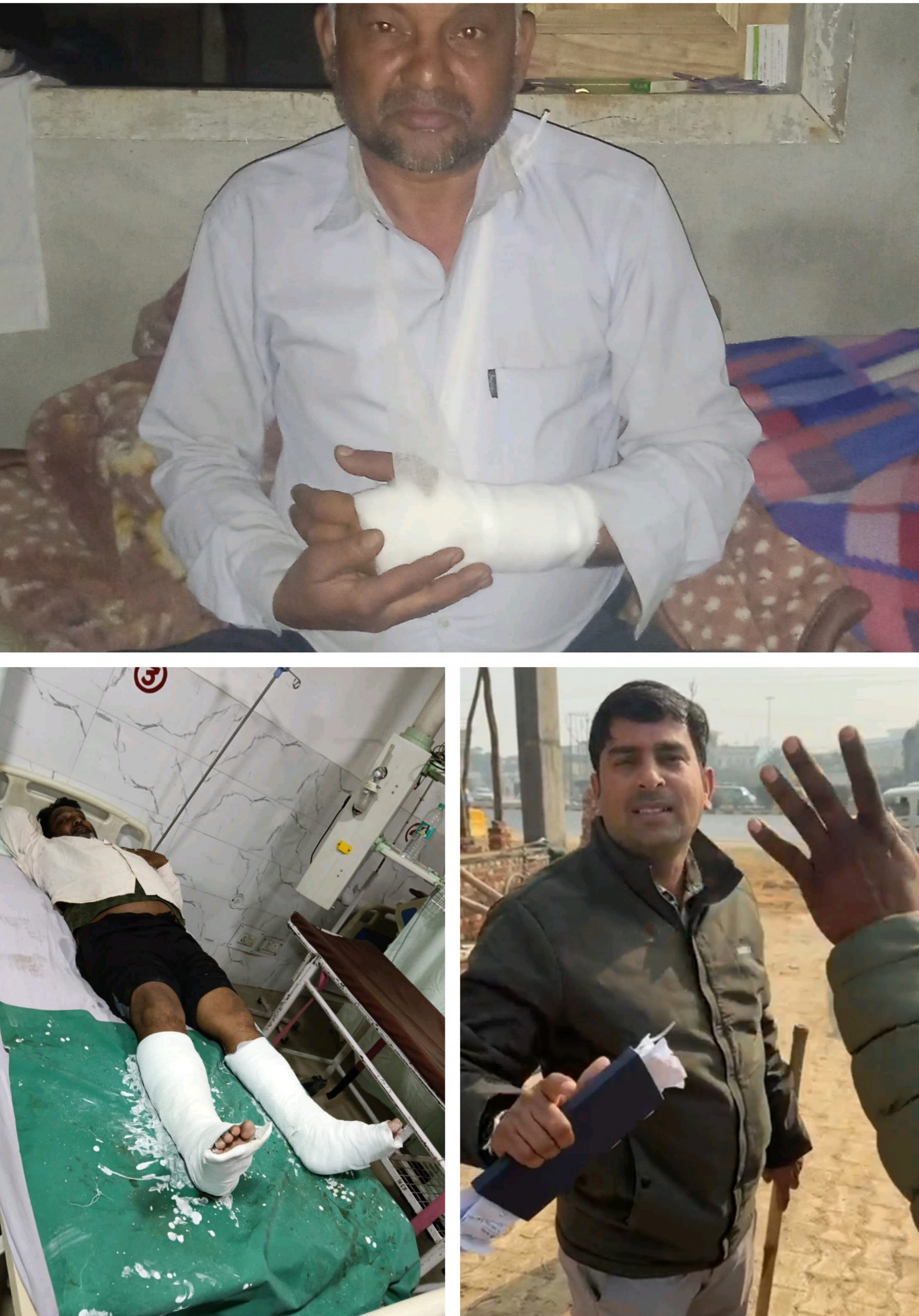 एमडीए के डंडे वाले जेई का कहर दो मजदूरों के हाथ पैर टूटे, अस्पताल में भर्ती