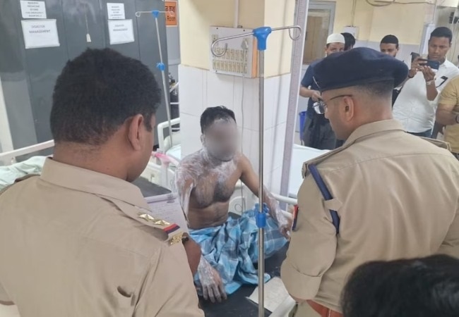 पत्नी के साथ अवैध संबंध का शक, पति ने तेजाब से नहला दिया रिश्तेदार को