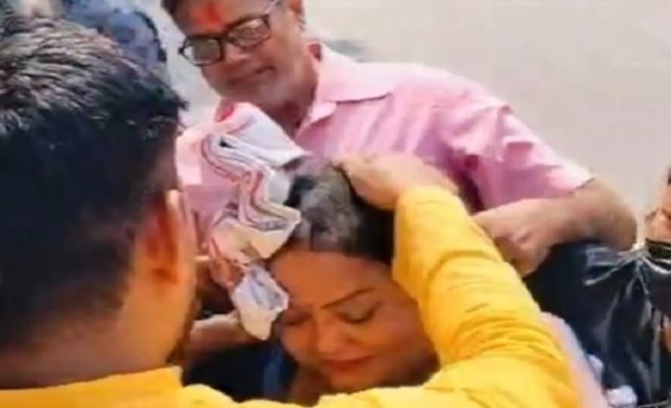 विपक्ष के नेताओं का पुलता फूंकते समय आग की चपेट में आईं BJP विधायक अनुपमा जायसवाल, चेहरा झुलसा