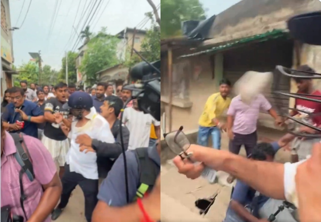 Abhishek Banerjee attacked Video : हेलमेट न होता तो अभिषेक बनर्जी की जा सकती थी जान, छाती पर जमे खून के थक्के