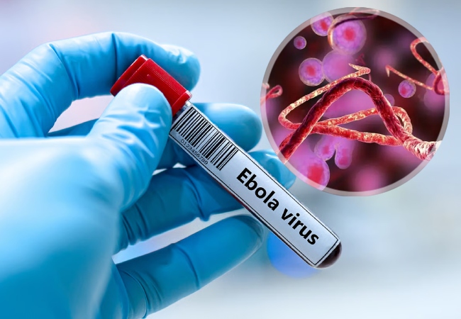 India Ebola Virus First Case : भारत में कोरोना से भी खतरनाक वायरस 'इबोला' की एंट्री, बेंगलुरु में महिला को किया गया क्वारंटीन